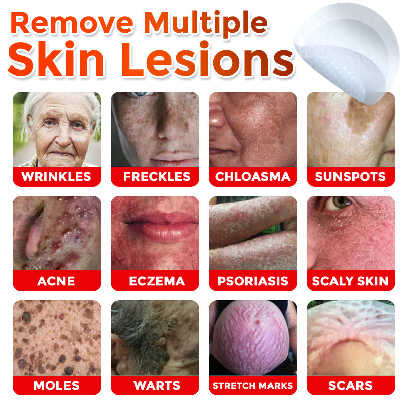 🌈MicroNeedle Botanic Skin Tag Removal Patch 🇺🇸 Made in the USA