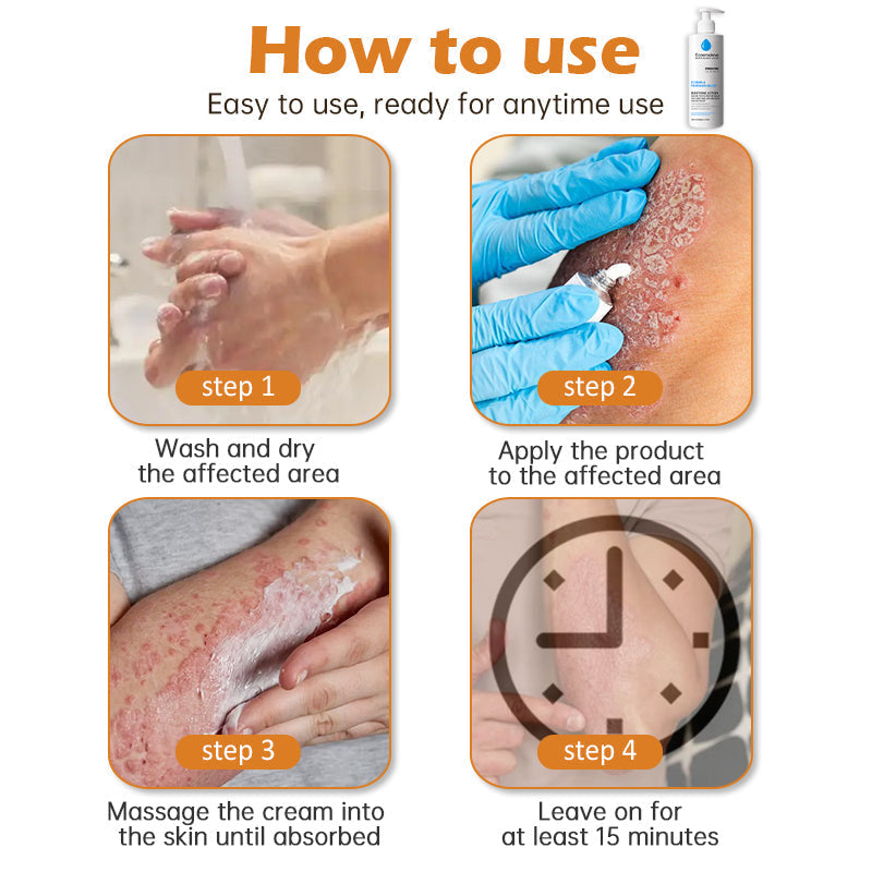 Eczemalieve® Eczema & Psoriasis Relief Lotion with “Liquid Gold” Oil