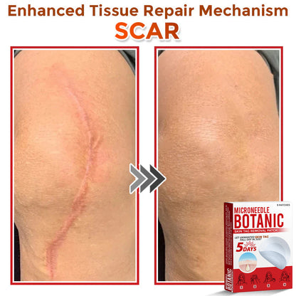 🌈MicroNeedle Botanic Skin Tag Removal Patch 🇺🇸 Made in the USA